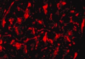 Human/Rat/Hamster ACE‑2 Antibody MAB9331