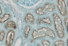Human/Rat/Hamster ACE‑2 Antibody MAB9332