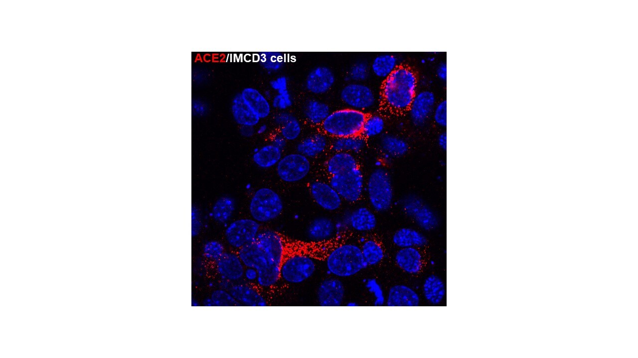 Human/Hamster ACE‑2 Antibody MAB933