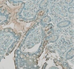 Human/Hamster ACE‑2 Antibody MAB933