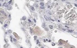 Human/Hamster ACE‑2 Antibody MAB933