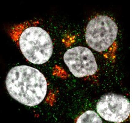 Human/Hamster ACE‑2 Antibody MAB933