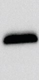 Human Ferritin Antibody MAB93541