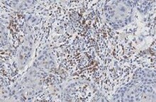 Human BTNL8 Antibody MAB93591