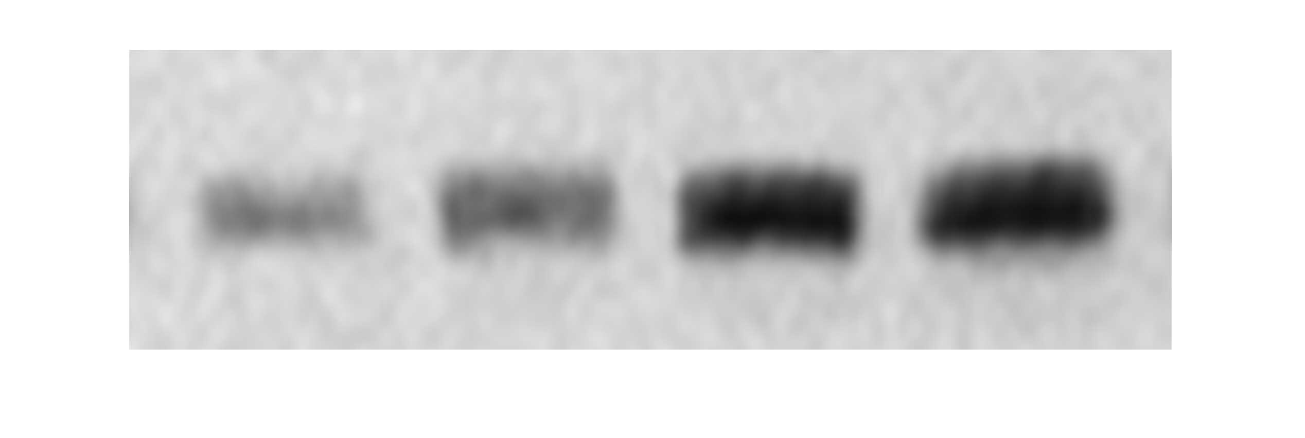 Human ADAM15 Ectodomain Antibody MAB935