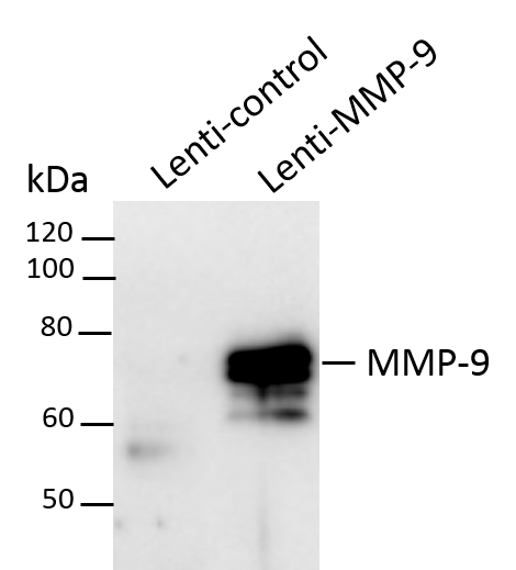 Human/Primate MMP-9 Antibody MAB936