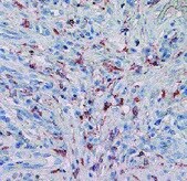 Human/Primate MMP-9 Antibody MAB936