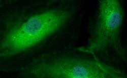 Human VE‑Cadherin Antibody MAB9381