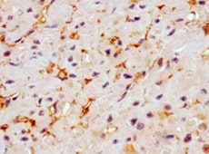 Human Irisin/FNDC5 Antibody MAB9420