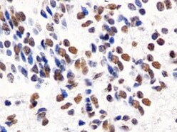 Human HIST3H3 Antibody MAB9448