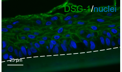 Human Desmoglein‑1 Antibody MAB944