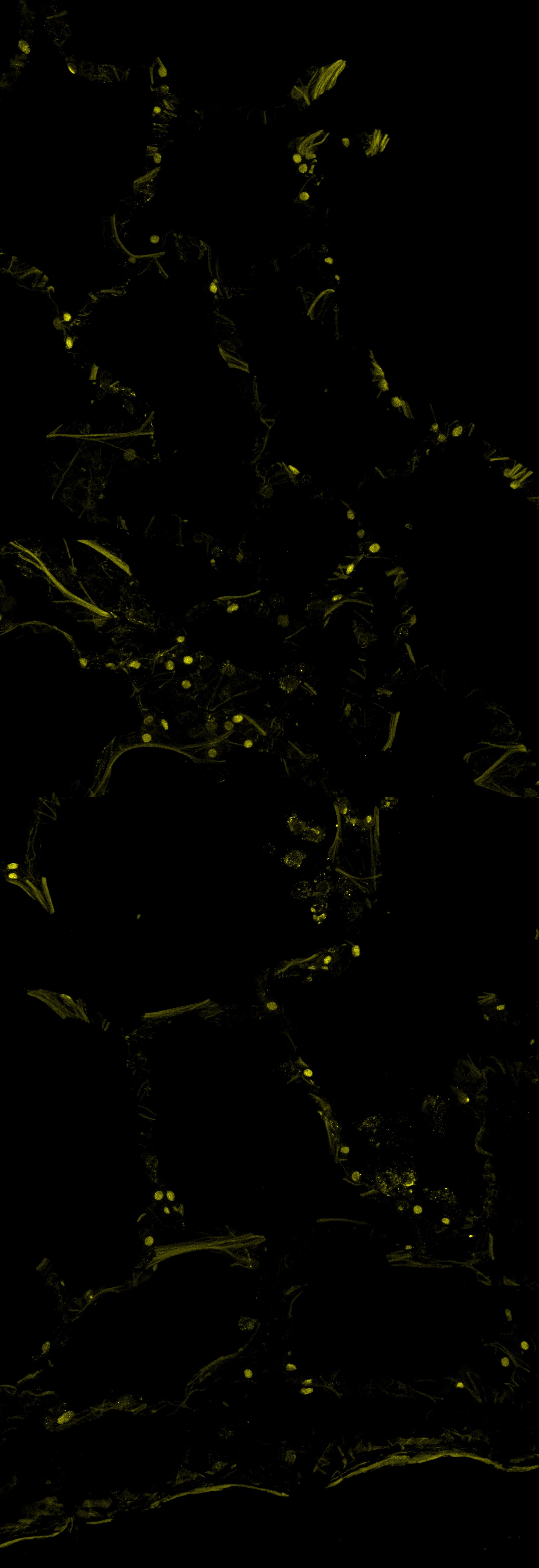 Human TTF-1/NKX2-1 Antibody MAB94581
