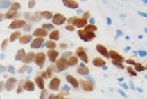Human TTF-1/NKX2-1 Antibody MAB94581