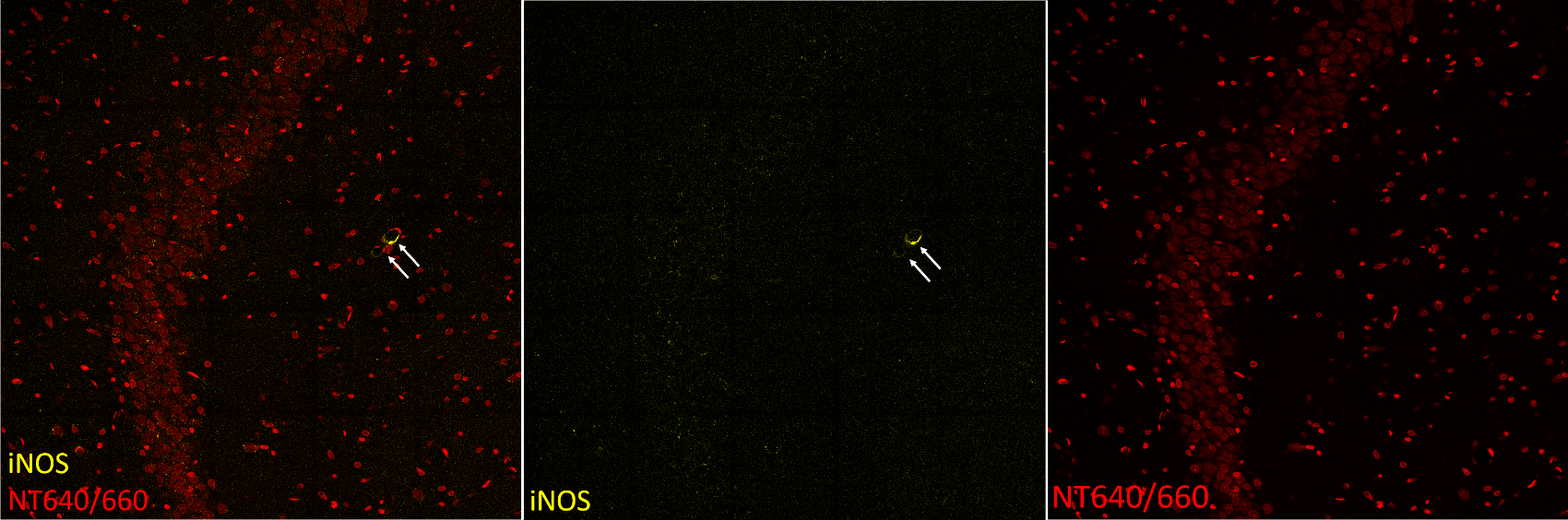 Human/Mouse/Rat iNOS Antibody MAB9502