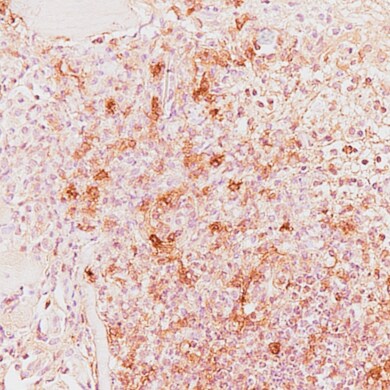 Human/Mouse/Rat iNOS Antibody MAB9502