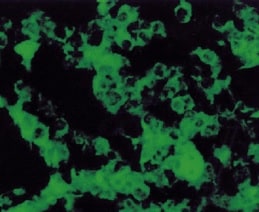 Human/Mouse/Rat iNOS Antibody MAB9502