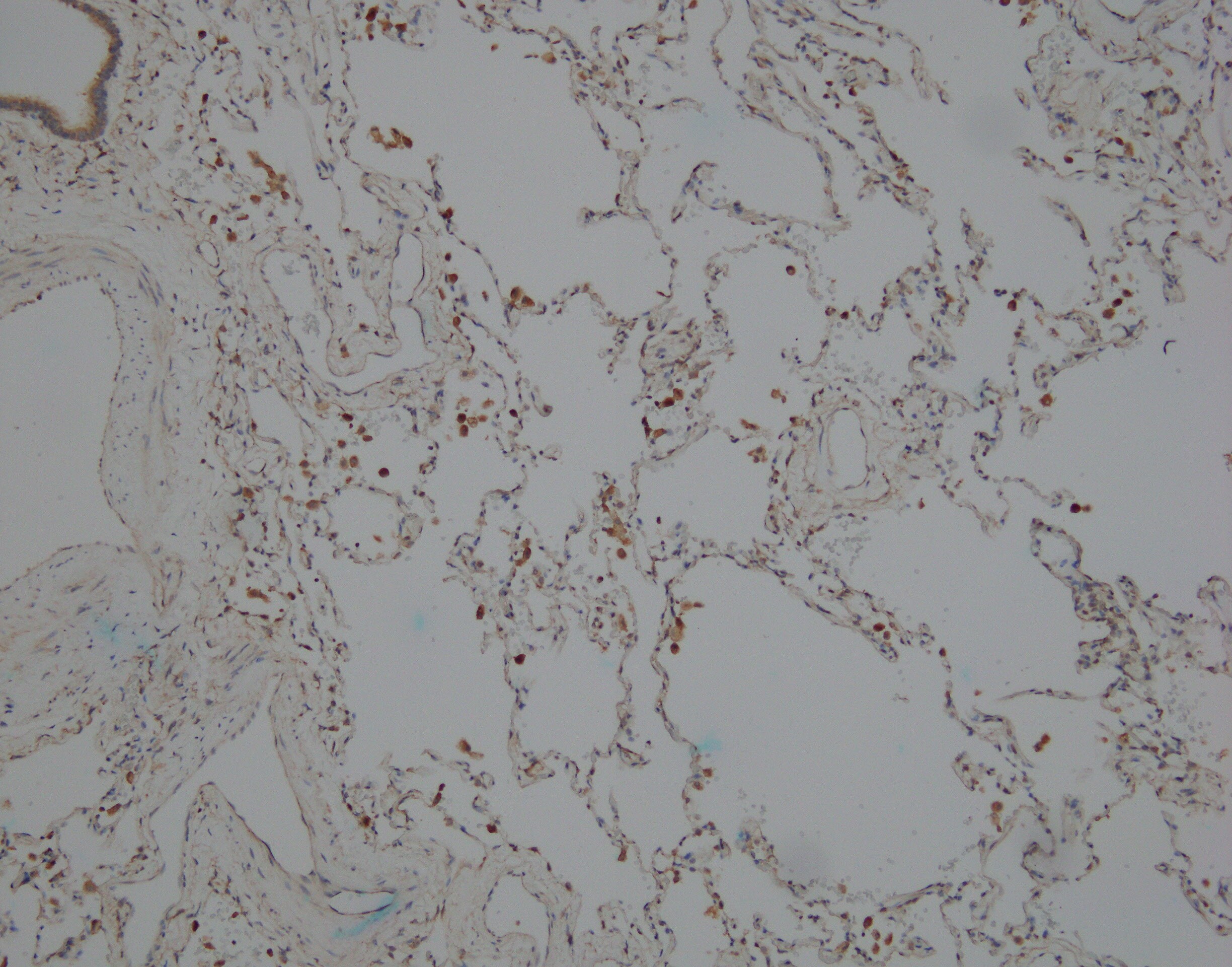 Human/Mouse/Rat iNOS Antibody MAB9502