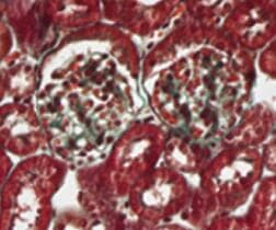 Human/Mouse Cathepsin L Antibody MAB9521