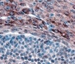 Human/Mouse Cathepsin L Antibody MAB9521