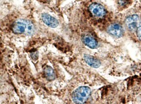 Human/Mouse Cathepsin L Antibody MAB9521