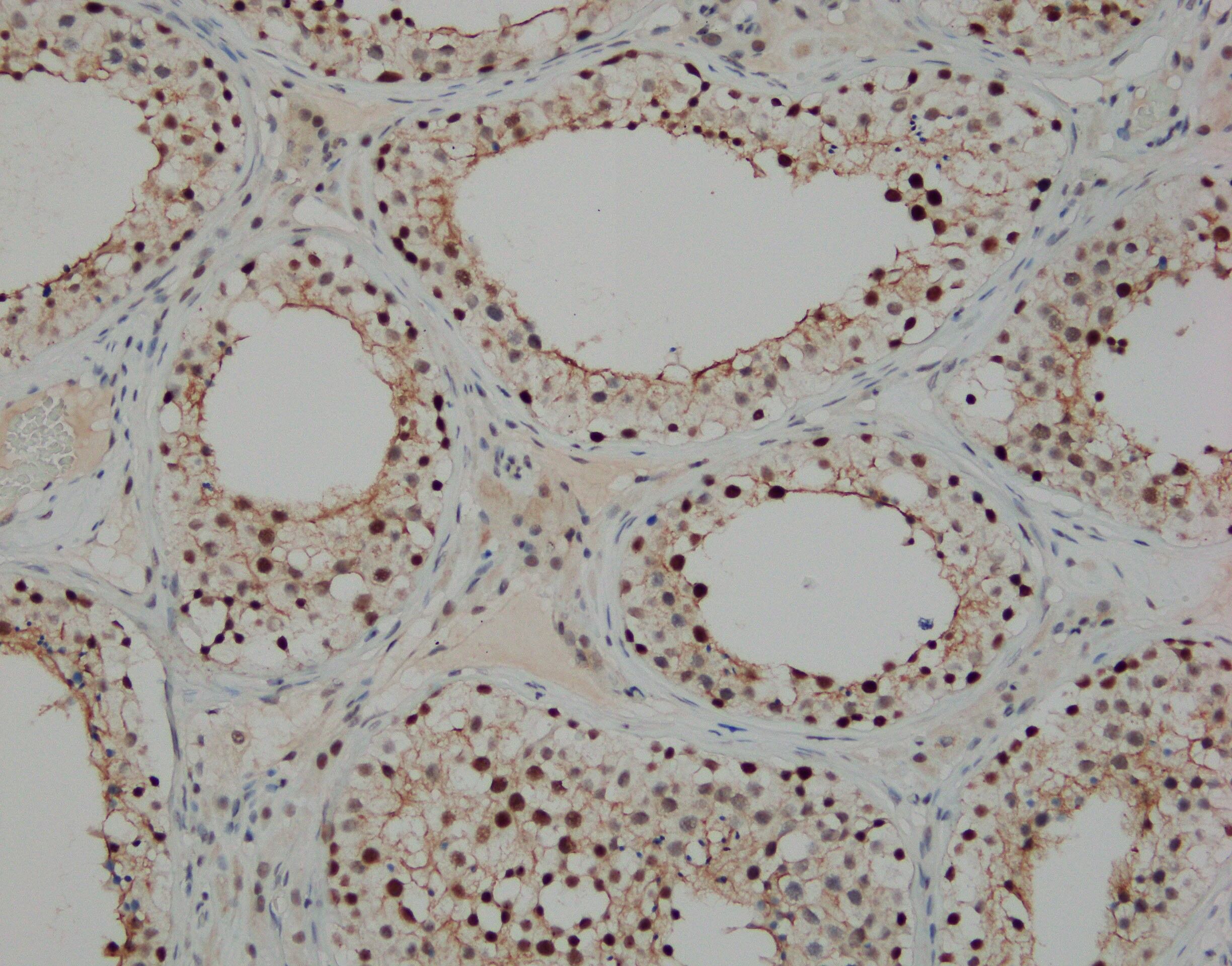 Human DUX4 Antibody MAB9535