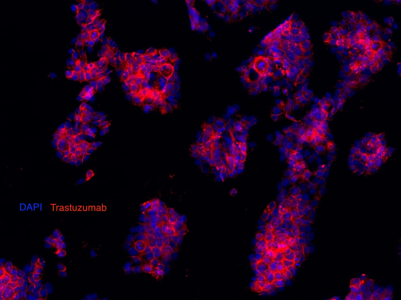 Anti- Trastuzumab (Anti-Idiotype) Antibody MAB95471
