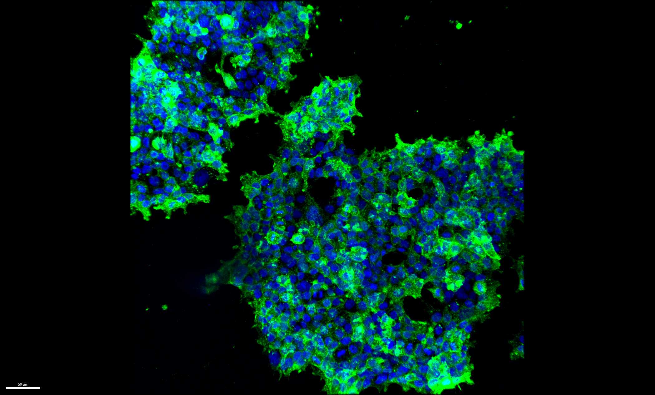 Human ErbB2/Her2 (Research Grade Trastuzumab Biosimilar) Antibody MAB9589