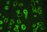 Human EpCAM/TROP‑1 Antibody MAB960