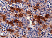 Human ZNF10 Antibody MAB96561