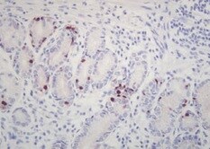 Human TIMP‑1 Antibody MAB970