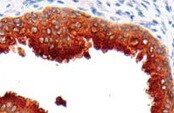 Human TIMP‑1 Antibody MAB970