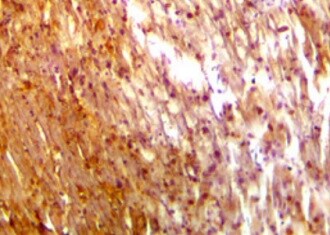 Human Myoglobin Antibody MAB97202