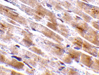 Human Myoglobin Antibody MAB97204