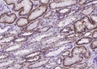 Human EMMPRIN/CD147 Antibody MAB9721