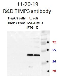 Human TIMP‑3 Antibody MAB973