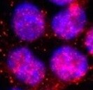 Human/Mouse/Rat alpha Actinin 2 Antibody MAB9830