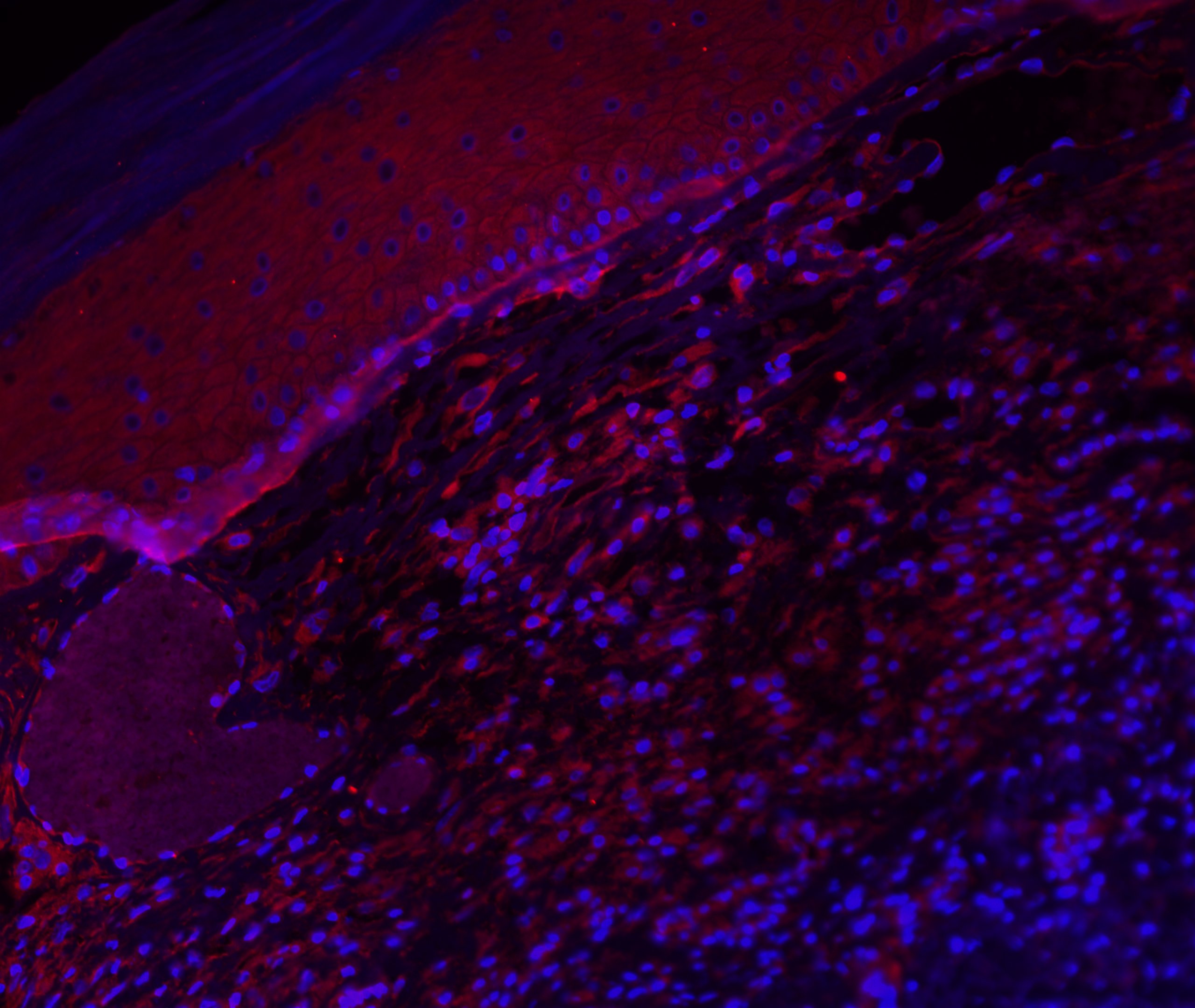Human IgD Antibody MAB9857