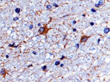 Human IMPA1/IMP1 Antibody MAB9890
