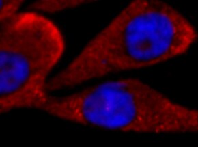 Human RSK1 Antibody MAB992