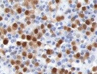 Human PSGL‑1/CD162 Antibody MAB9961