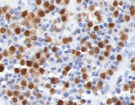 Human PSGL‑1/CD162 Antibody MAB9962