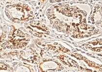 Human LPAR1/LPA1/EDG-2 Antibody MAB9963