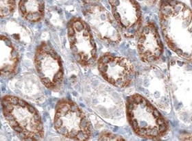 Human RTTN Antibody MAB9966