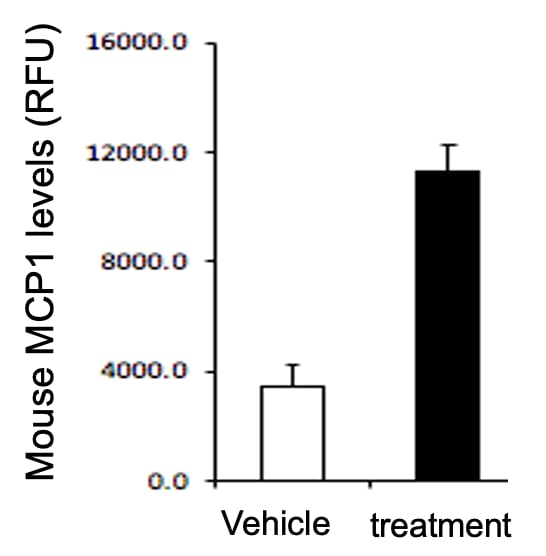 Mouse CCL2/JE/MCP-1 Quantikine ELISA Kit MJE00B