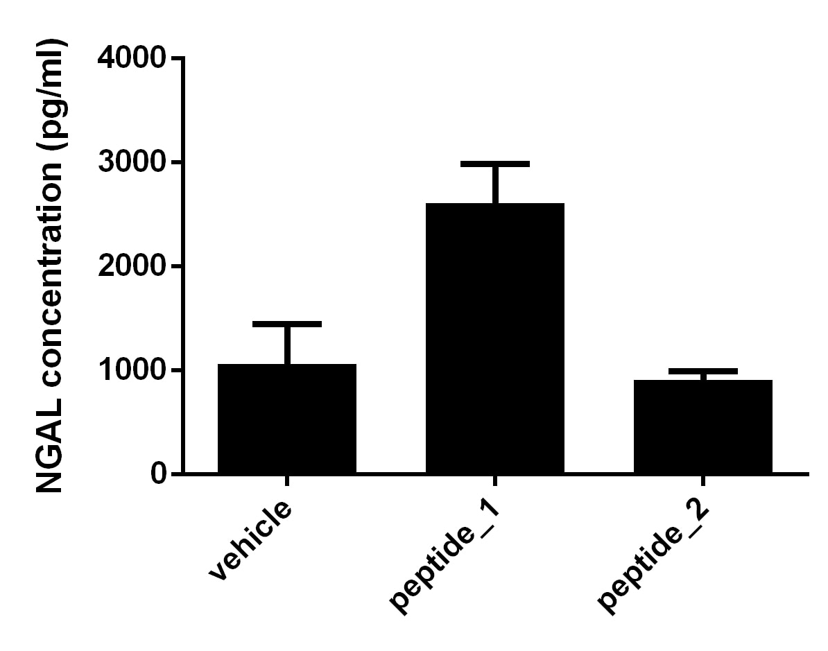 Mouse Lipocalin-2/NGAL Quantikine ELISA Kit MLCN20