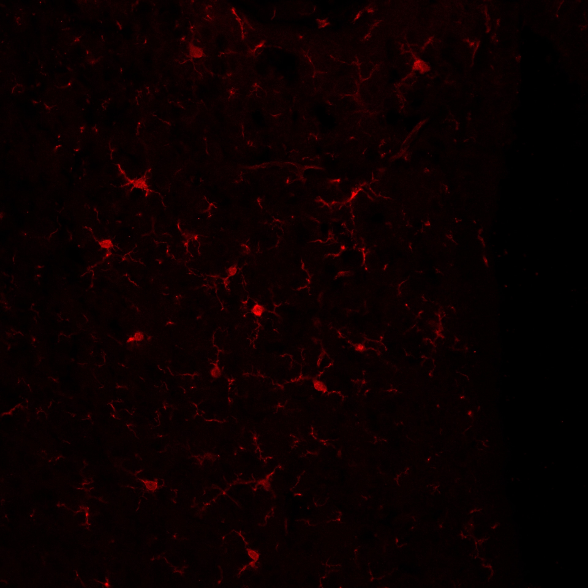 AIF-1/Iba1 Antibody NB100-1028