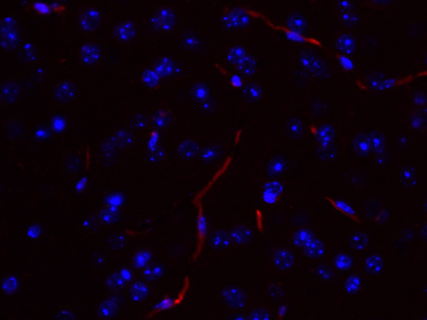 AIF-1/Iba1 Antibody NB100-1028
