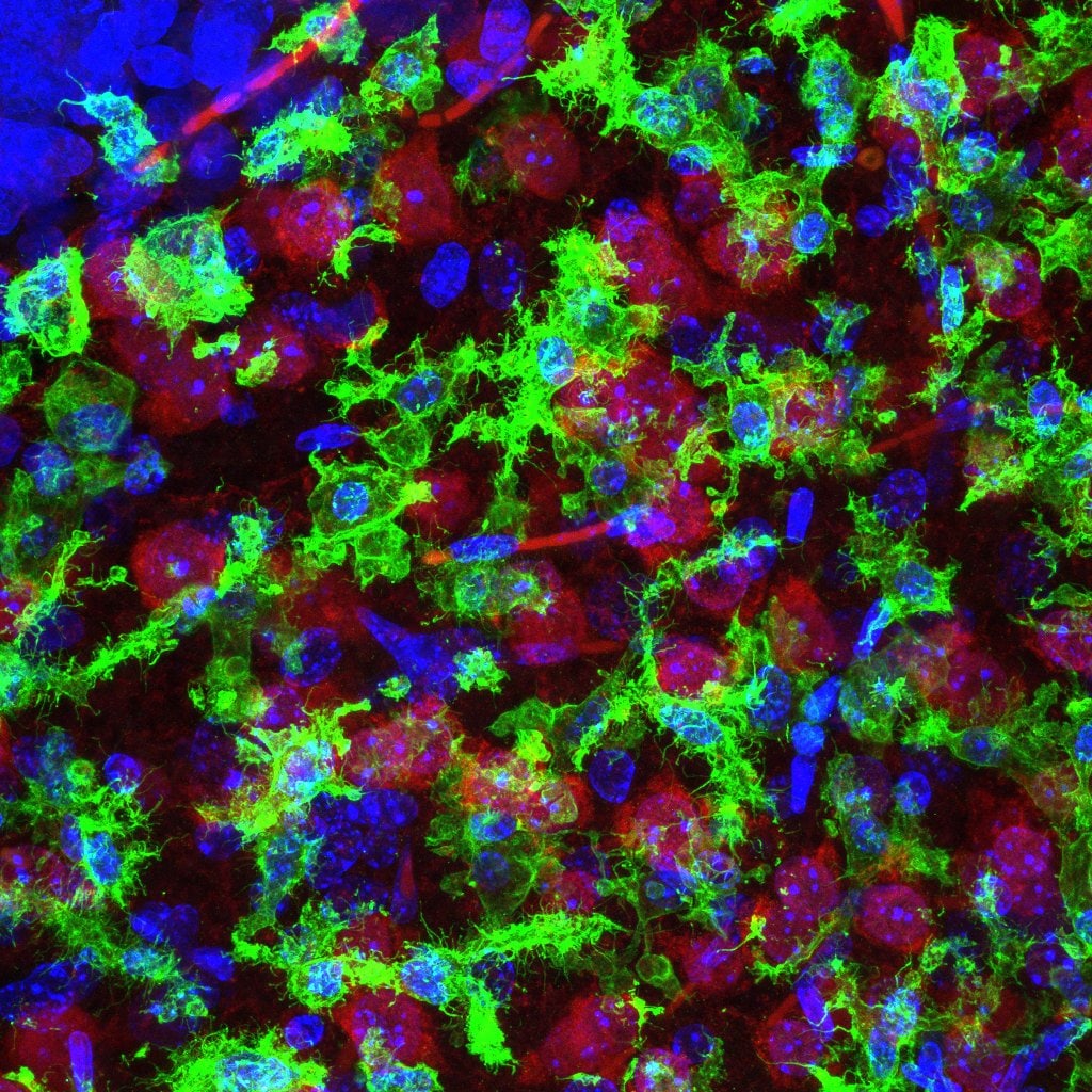 AIF-1/Iba1 Antibody NB100-1028