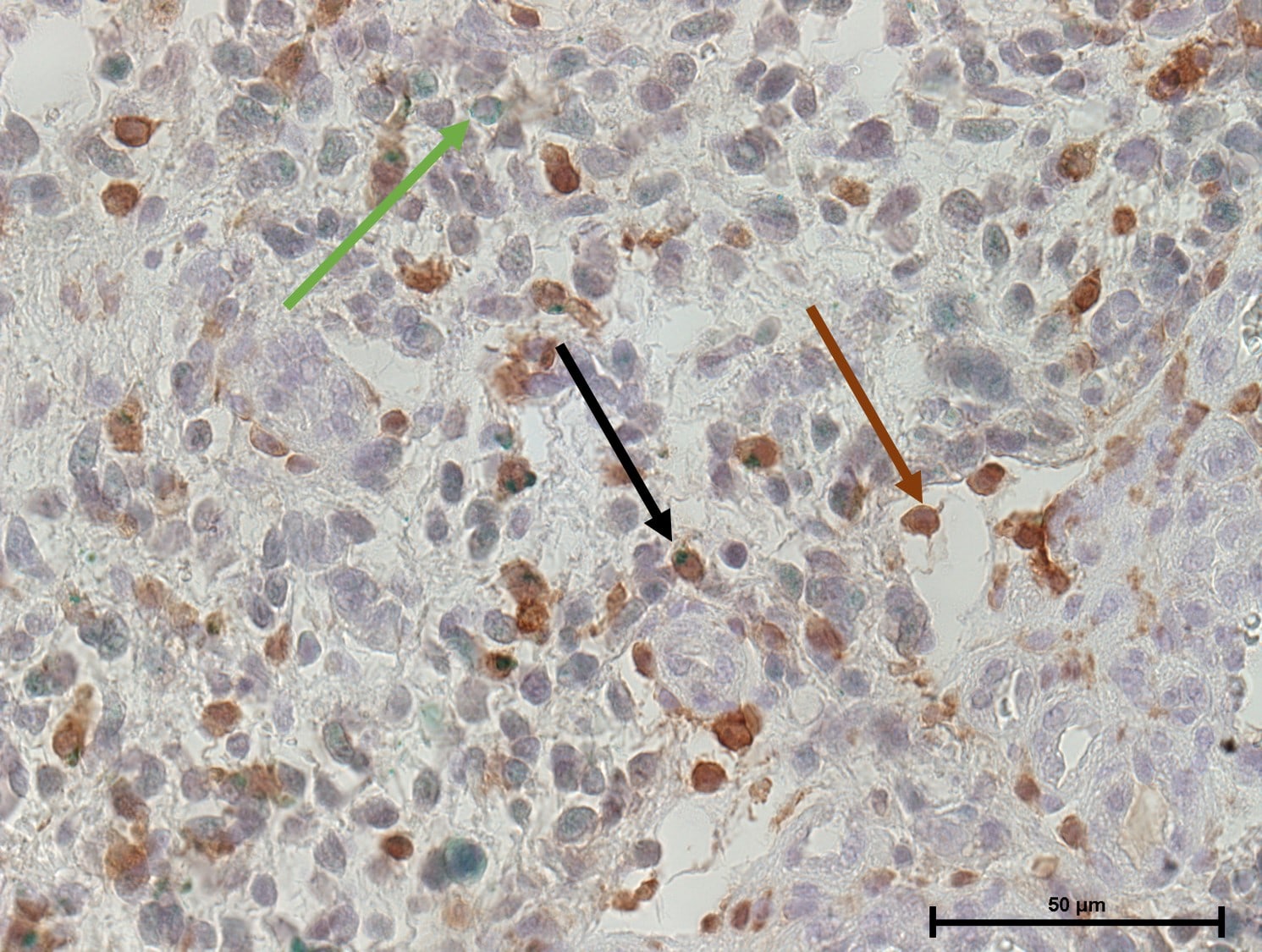 AIF-1/Iba1 Antibody NB100-1028