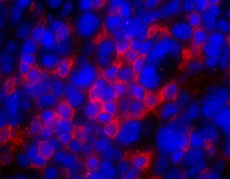AIF-1/Iba1 Antibody NB100-1028